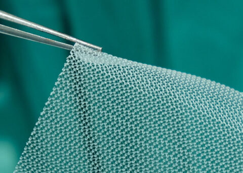 Transvaginal Mesh | The Sentinel Group